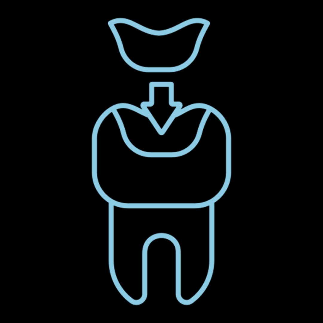 Icon servicios Incrustación Dental